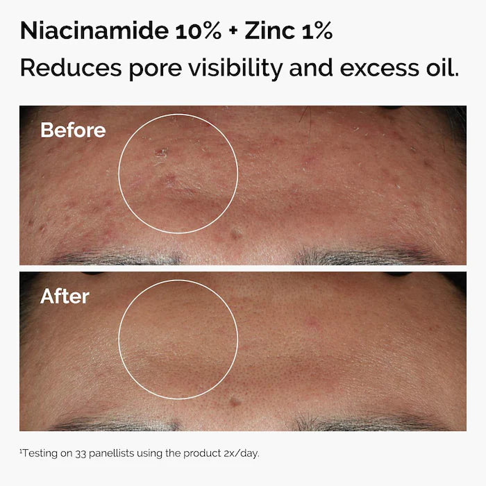 THE ORDINARY SET WITH NIACINAMIDE + HYALURONIC ACID