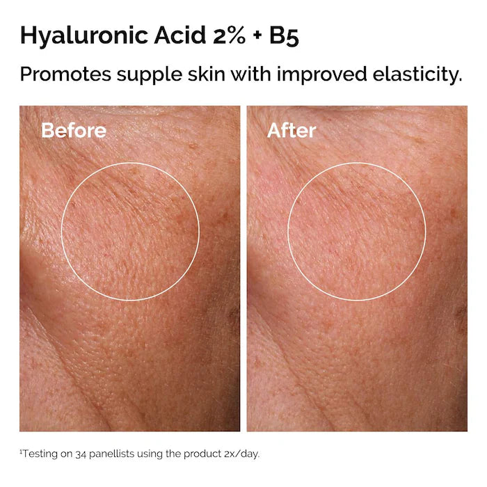 THE ORDINARY SET WITH NIACINAMIDE + HYALURONIC ACID