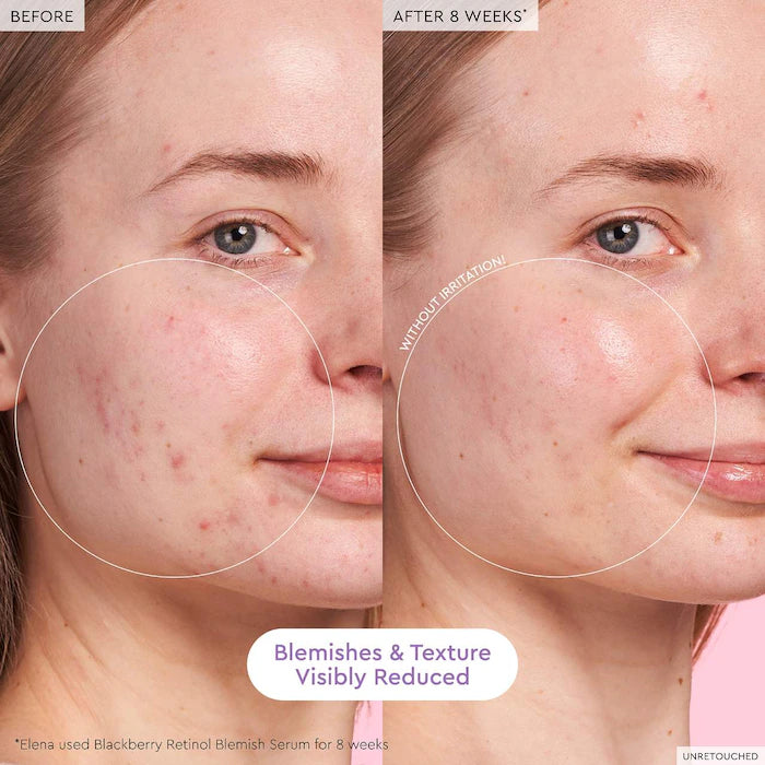 GLASS SKIN HYDRATION KIT