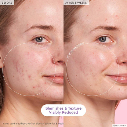 GLASS SKIN HYDRATION KIT